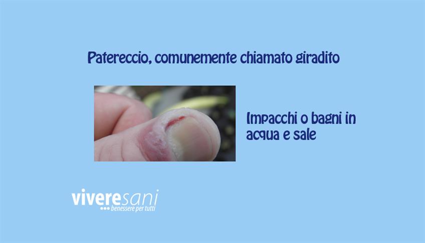 Che dolore il giradito! Che dolore il giradito!